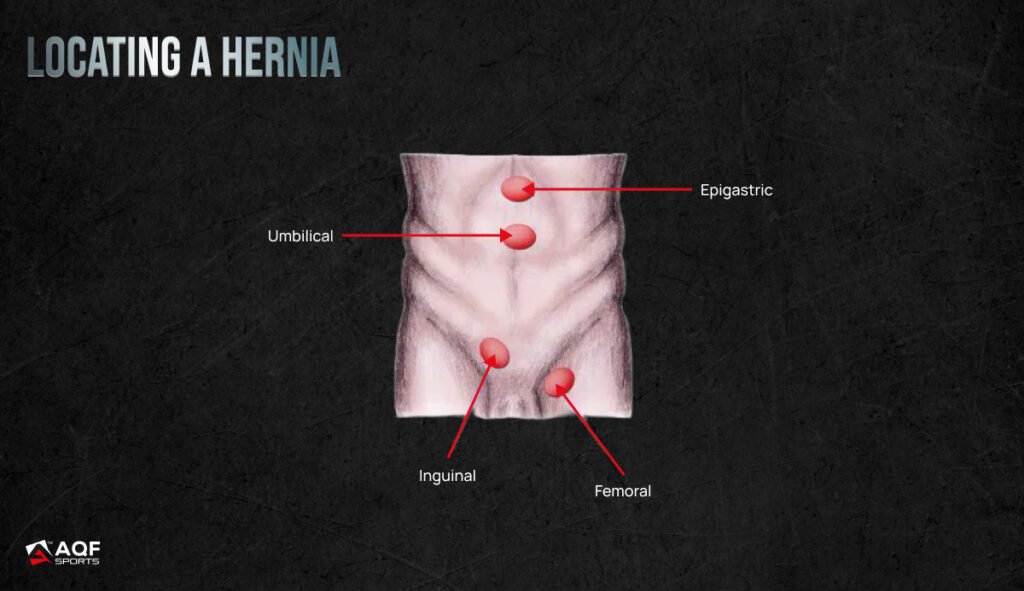 How to locating hernia? if you are having it.